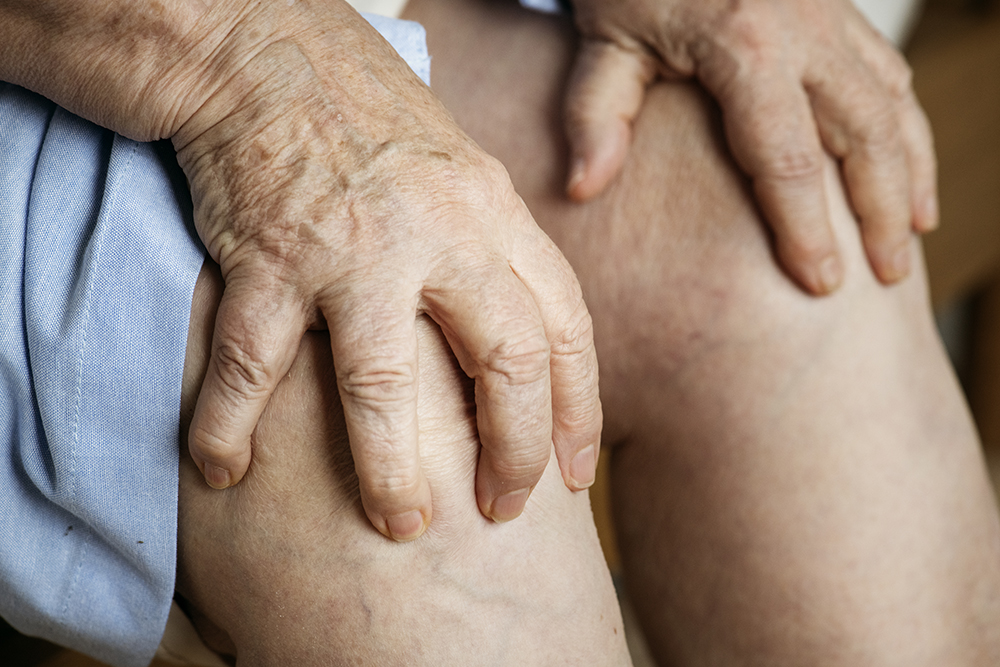 Post-Op MPFL Reconstruction Physical Therapy elderly woman suffering knee pain 2022 12 15 23 40 35 utc post-op mpfl reconstruction physical therapy knee pain