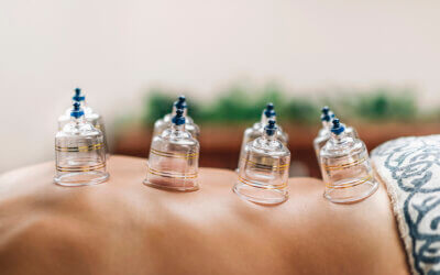 The 4 key purposes that cupping serves during PT